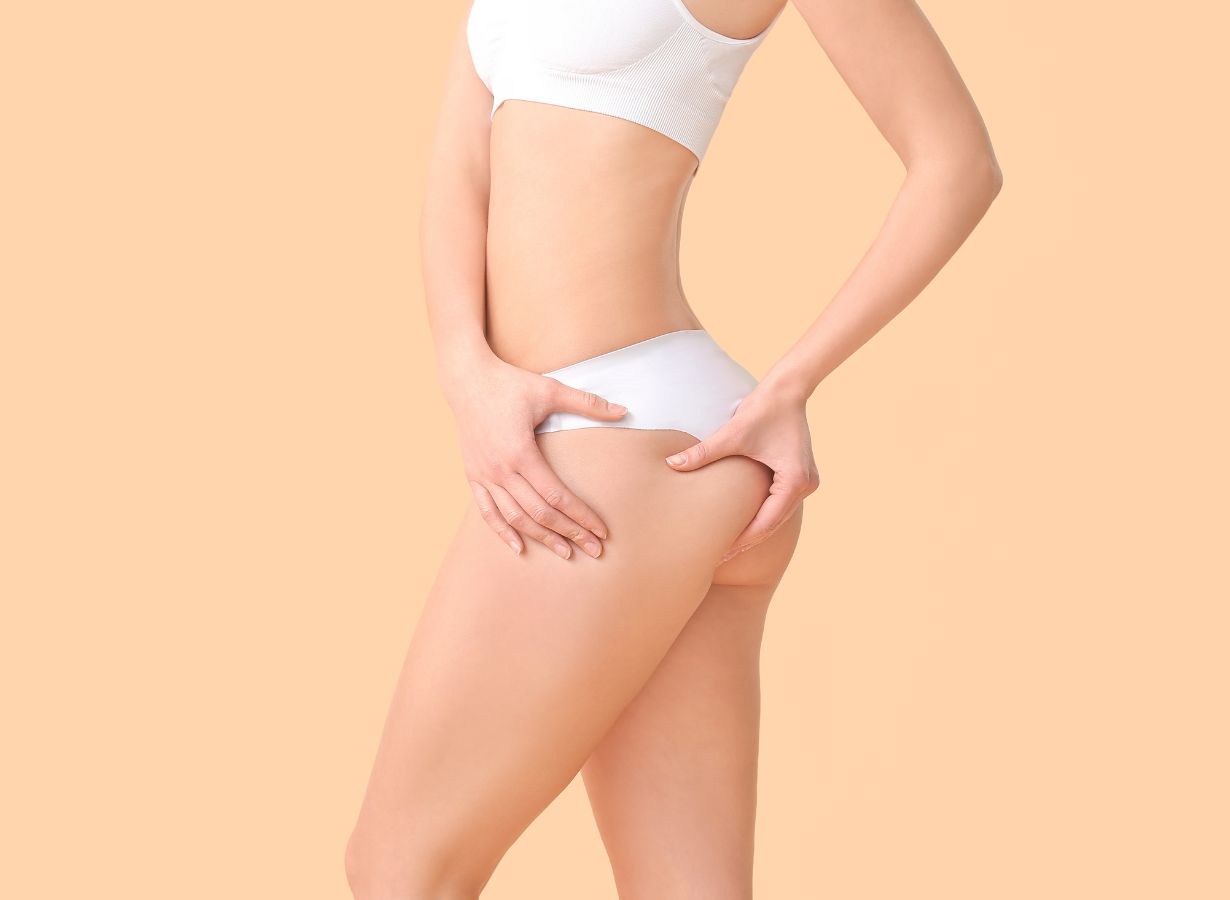 8 Common Myths About Cellulite