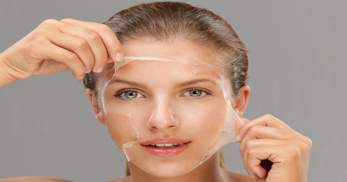 chemical peel