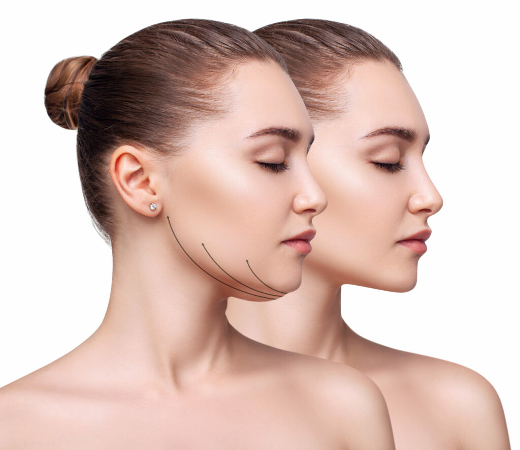 Skin Tightening Solutions
